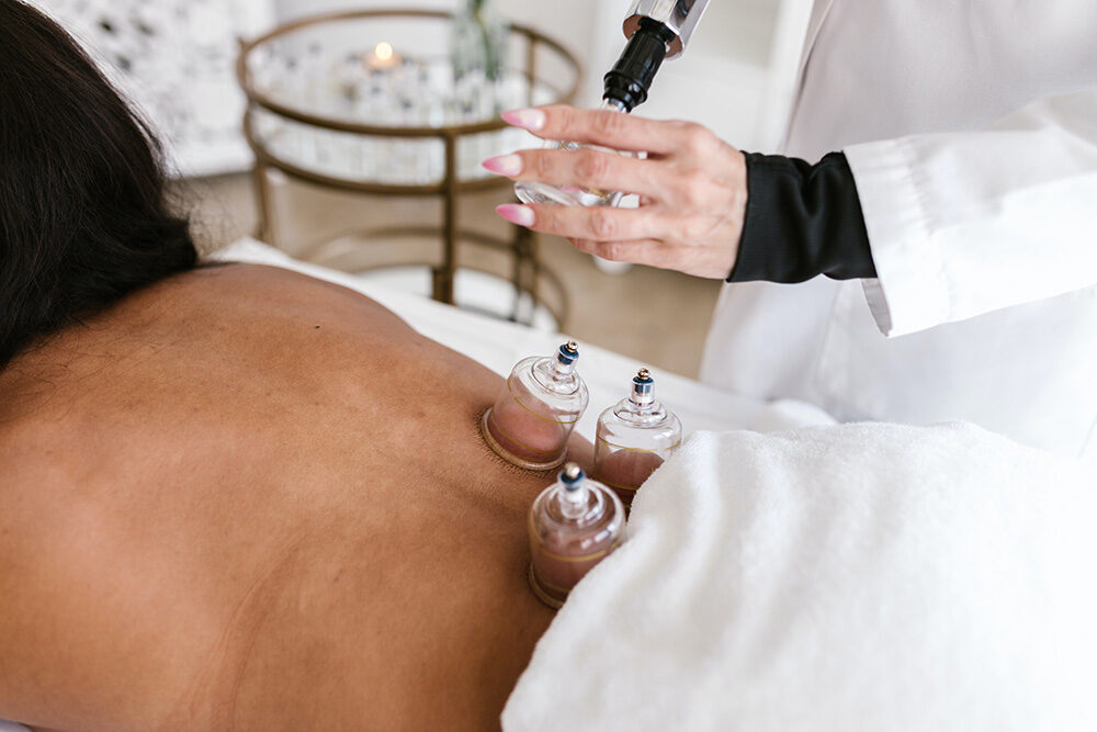 Cupping Therapy